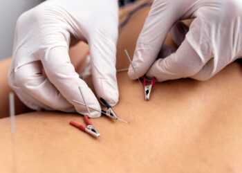 Γνωρίστε τον Ηλεκτροβελονισμό